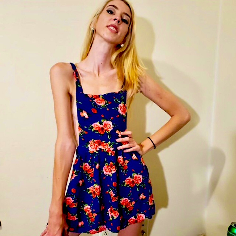 Floral Overall Dress